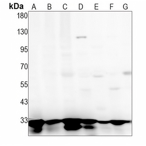 Cyclin D3 Rabbit Monoclonal Antibody(C1292)