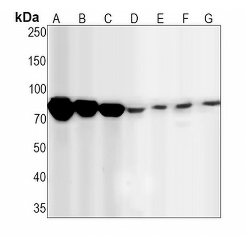 STAT1 Rabbit Monoclonal Antibody(C1293)