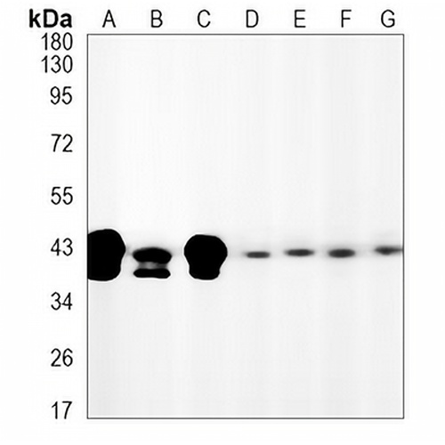 JUNB Rabbit Monoclonal Antibody(C1296)