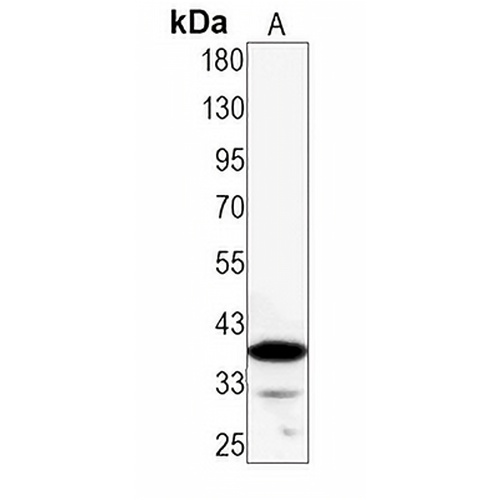 AMPK beta 1 Rabbit Monoclonal Antibody(C1297)