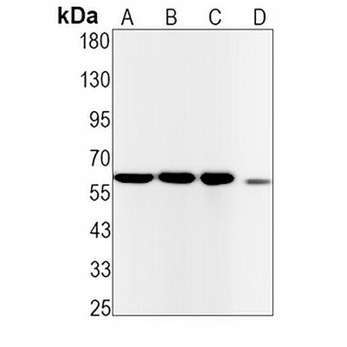 CDC25B Rabbit Monoclonal Antibody(C1299)