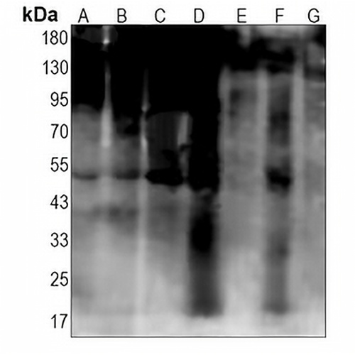 Ubiquitin (Linkage specific-K48) Rabbit Monoclonal Antibody(C1304)
