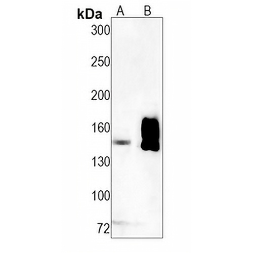 CD49e Rabbit Monoclonal Antibody(C1306)
