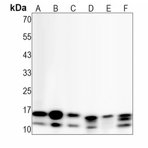 LC3B Rabbit Monoclonal Antibody(C1307)