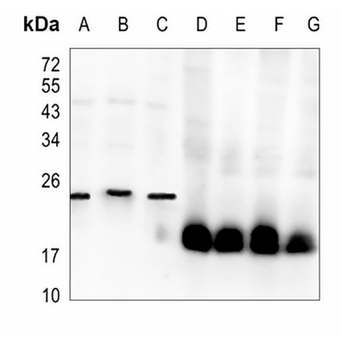 SOD1 Rabbit Monoclonal Antibody(C1309)