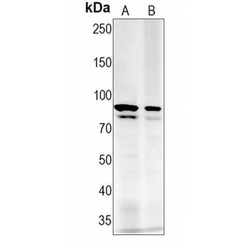 FOXP1 Rabbit Monoclonal Antibody(C1310)