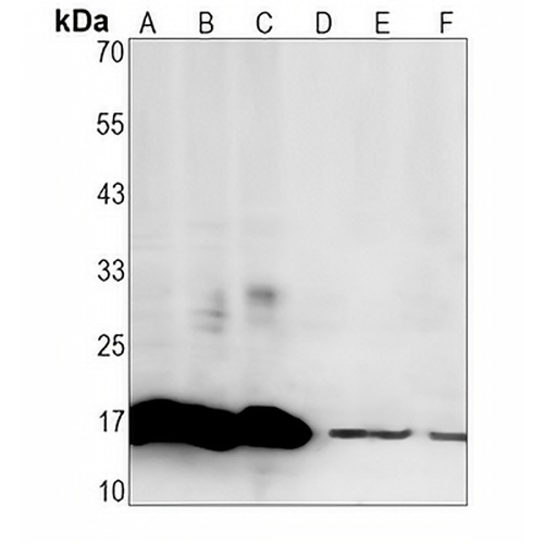 CD59  Rabbit Monoclonal Antibody(C1311)