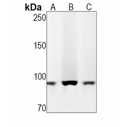 CD18  Rabbit Monoclonal Antibody(C1313)