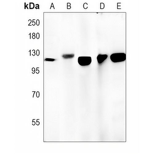 CD26 Rabbit Monoclonal Antibody(C1314)