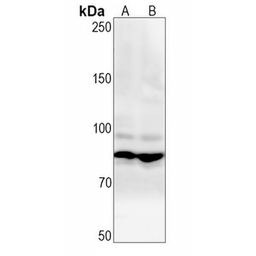 CHAT Rabbit Monoclonal Antibody(C1315)