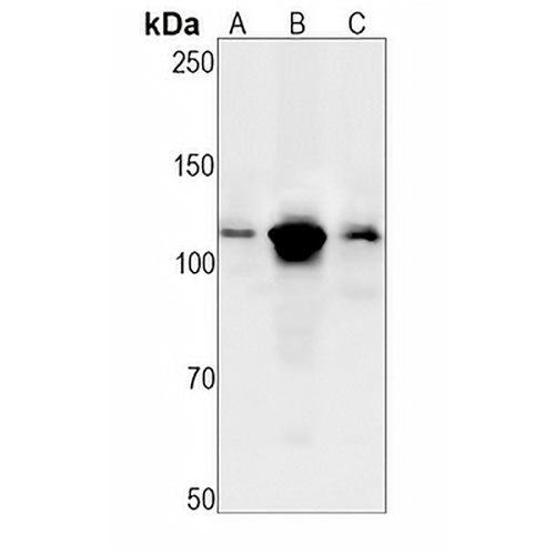 PARP1 Rabbit Monoclonal Antibody(C1316)