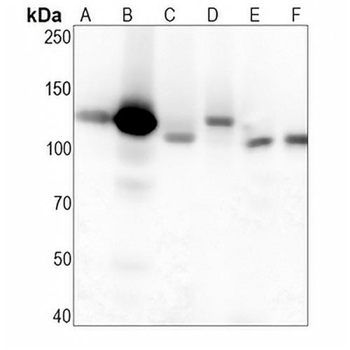 CD51  Rabbit Monoclonal Antibody(C1317)