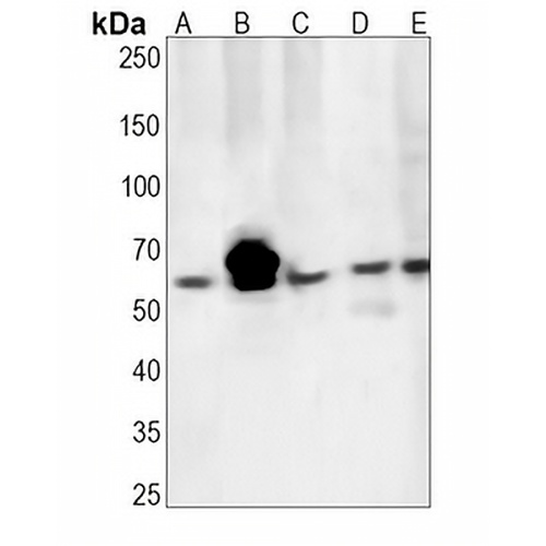 CD39 Rabbit Monoclonal Antibody(C1319)