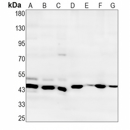 ATG4A Rabbit Monoclonal Antibody(C1322)