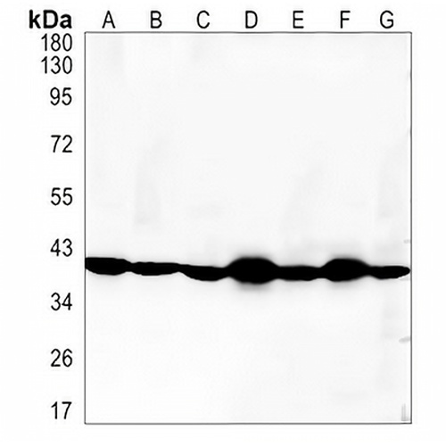 CCR8 Rabbit Monoclonal Antibody(C1323)