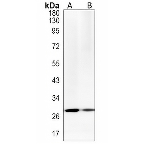 Calretinin Rabbit Monoclonal Antibody(C1325)