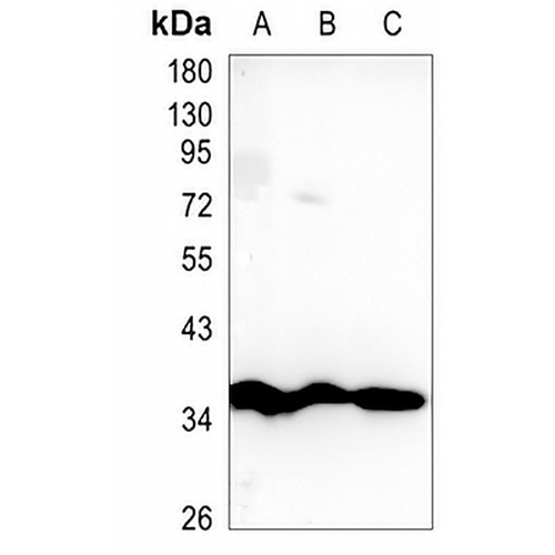 Thymidylate Synthase Rabbit Monoclonal Antibody(C1326)