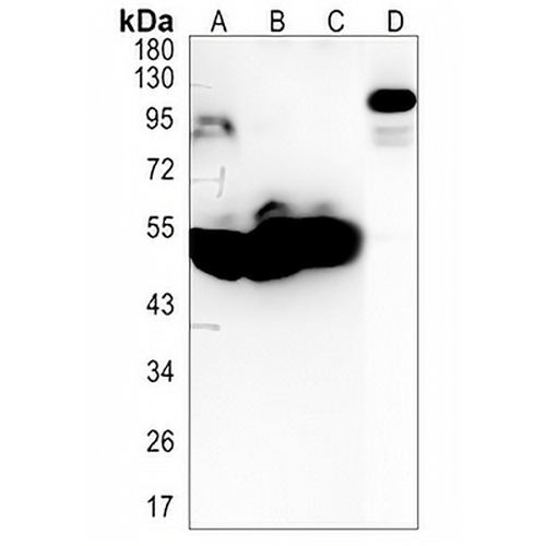 LOXL2 Rabbit Monoclonal Antibody(C1329)