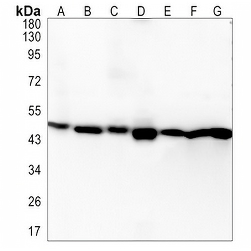UQCRC2 Rabbit Monoclonal Antibody(C1330)