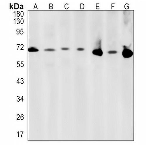 PCK2 Rabbit Monoclonal Antibody(C1331)