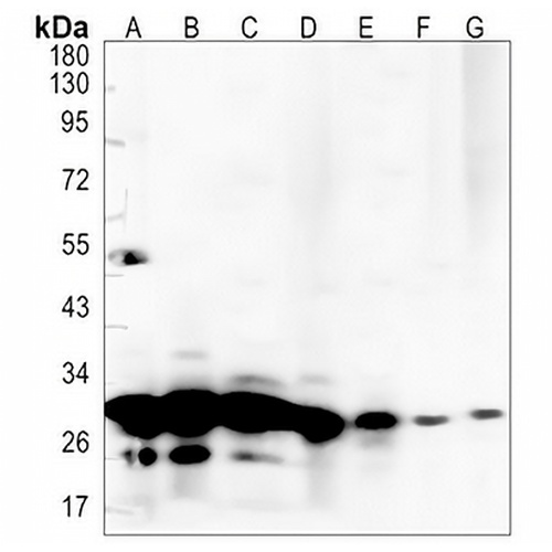 SF2 Rabbit Monoclonal Antibody(C1332)