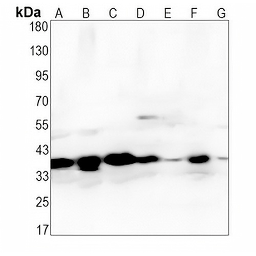 WDR5 Rabbit Monoclonal Antibody(C1333)