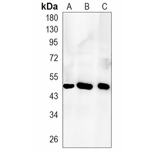SMYD3 Rabbit Monoclonal Antibody(C1334)