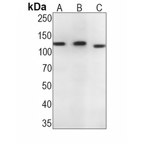 CD30 Rabbit Monoclonal Antibody(C1335)