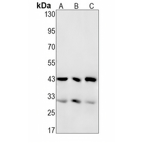 MBD2 Rabbit Monoclonal Antibody(C1336)