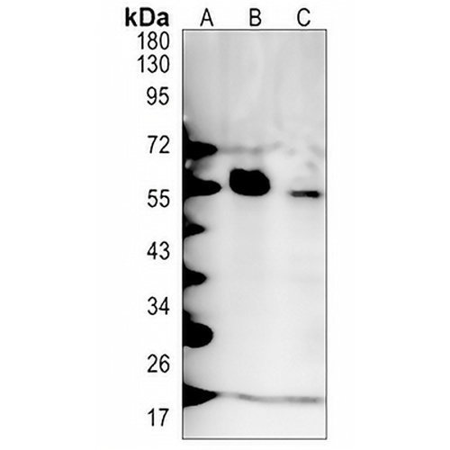 PFKFB3 Rabbit Monoclonal Antibody(C1337)