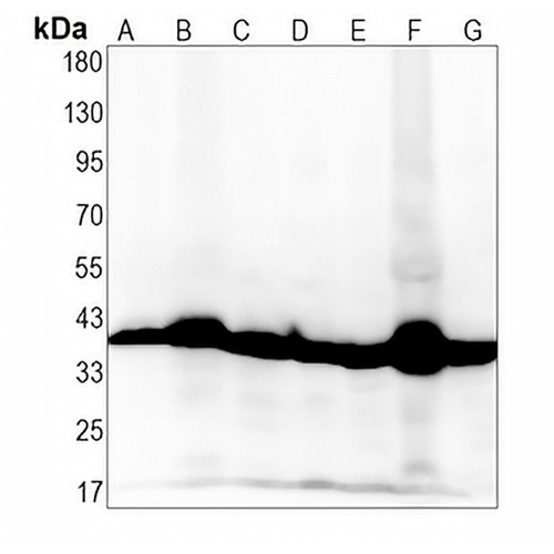 PDHB Rabbit Monoclonal Antibody(C1338)