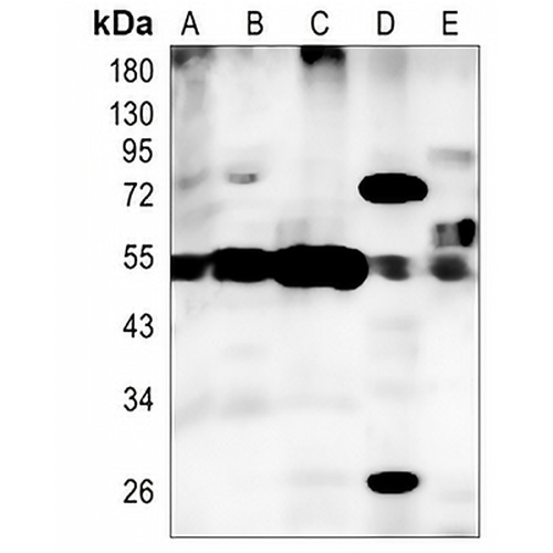 VDUP1 Rabbit Monoclonal Antibody(C1340)