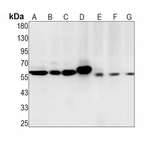 ERGIC-53 Rabbit Monoclonal Antibody(C1341)