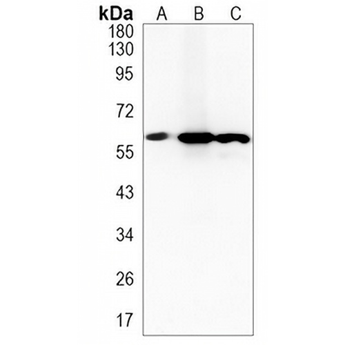 UAP1 Rabbit Monoclonal Antibody(C1343)