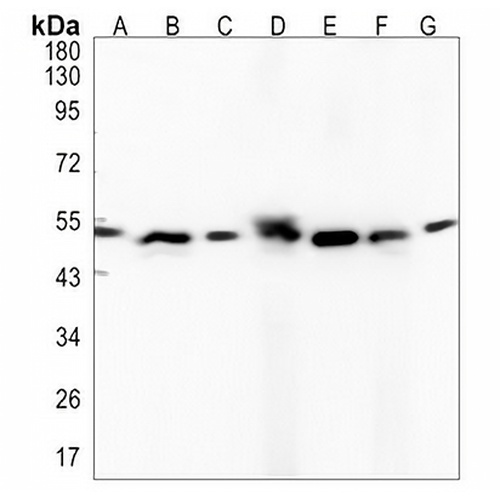 MST4 Rabbit Monoclonal Antibody(C1345)
