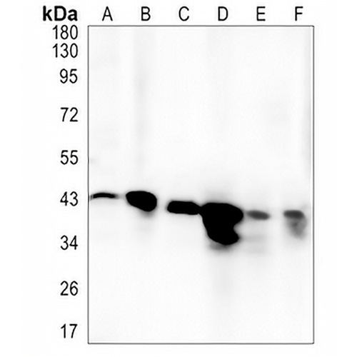 GALT Rabbit Monoclonal Antibody(C1346)