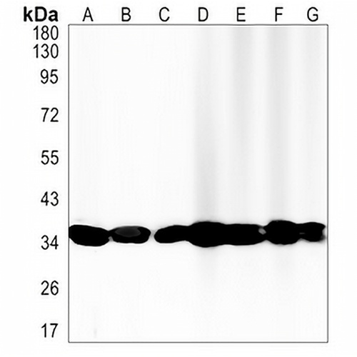 MDH2 Rabbit Monoclonal Antibody(C1347)