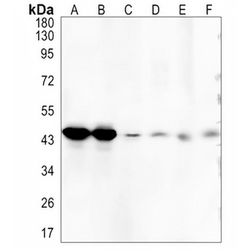 PSMC5 Rabbit Monoclonal Antibody(C1348)