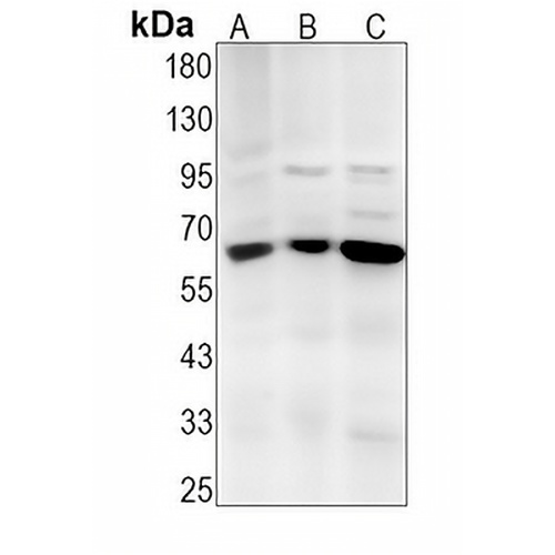 FPGS Rabbit Monoclonal Antibody(C1350)