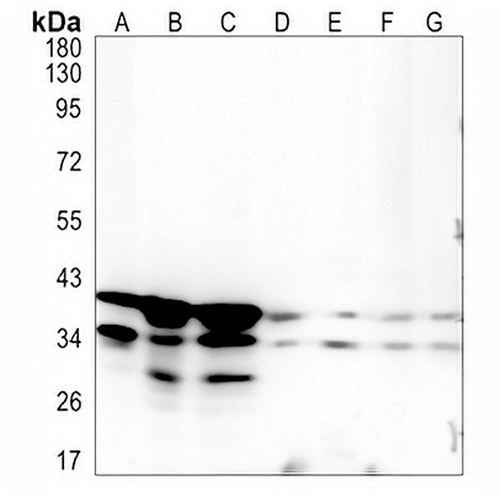 UFD1L Rabbit Monoclonal Antibody(C1351)