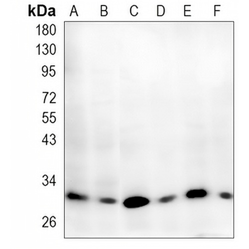 TMEM192 Rabbit Monoclonal Antibody(C1352)