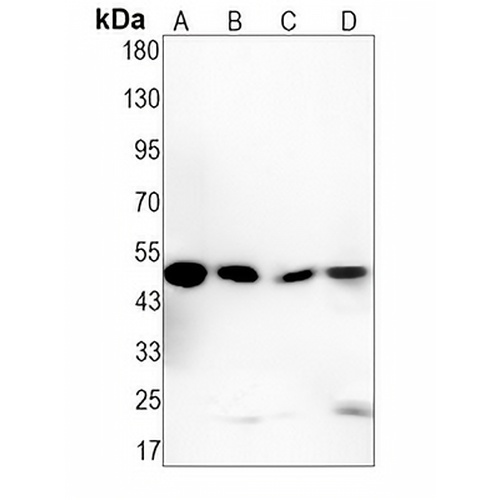 SNX5 Rabbit Monoclonal Antibody(C1353)