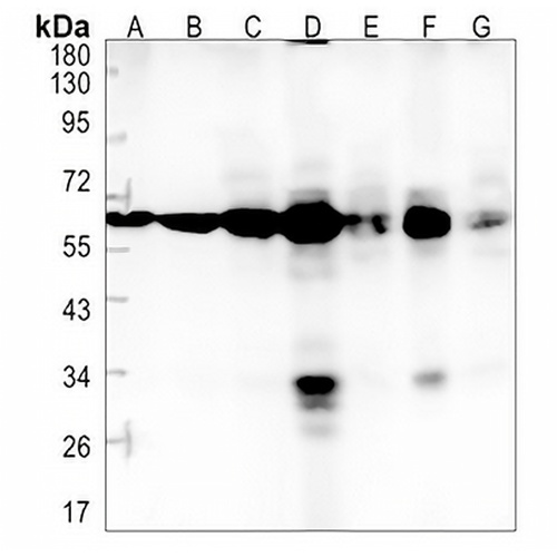 PGM1 Rabbit Monoclonal Antibody(C1355)