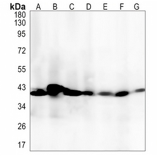 TMEM43 Rabbit Monoclonal Antibody(C1357)