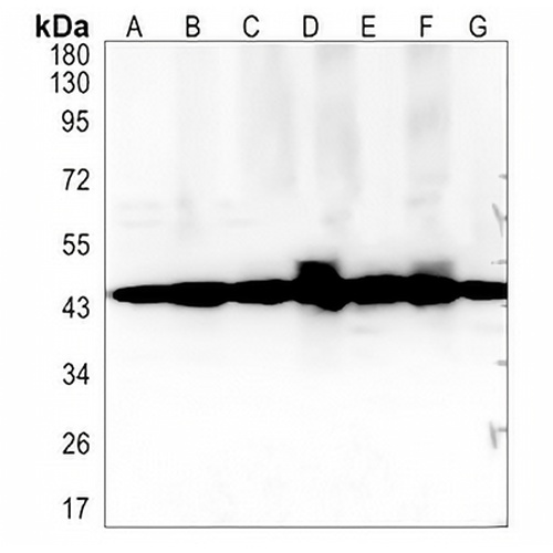 NDUFS2 Rabbit Monoclonal Antibody(C1359)