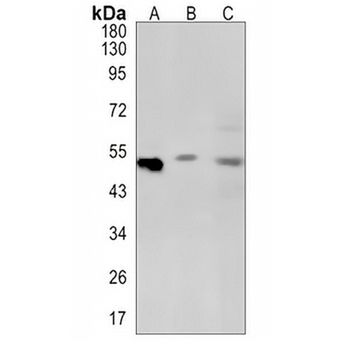 PPP2R5E Rabbit Monoclonal Antibody(C1360)