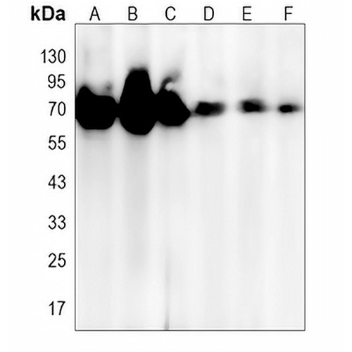 PREPL Rabbit Monoclonal Antibody(C1361)