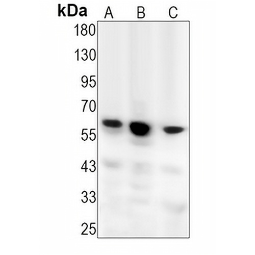 CDC73 Rabbit Monoclonal Antibody(C1363)
