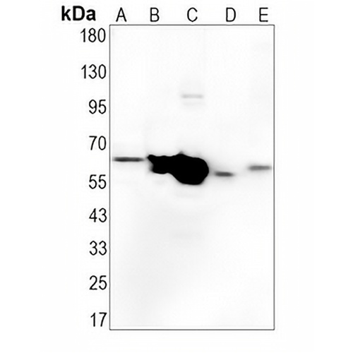Alpha-internexin Rabbit Monoclonal Antibody(C1364)