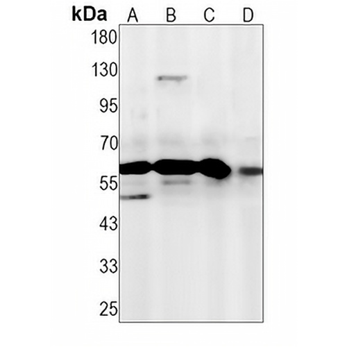 NR1D1 Rabbit Monoclonal Antibody(C1365)